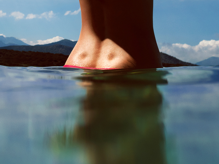 hg-back-dimples-in-water-732x549-thumbnail.jpg