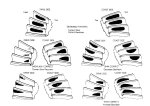 Contact pattern.jpg